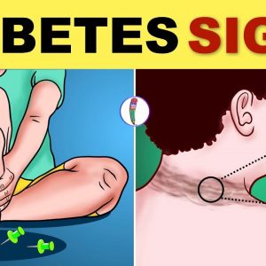 Diabetes Symptoms | Diabetes Mellitus | Type 2 Diabetes - Signs & Symptoms | Diabetes Warning Signs