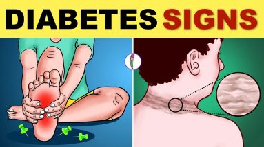 Diabetes Symptoms | Diabetes Mellitus | Type 2 Diabetes - Signs & Symptoms | Diabetes Warning Signs